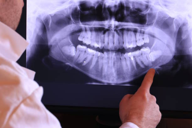 Best Tooth Infection Emergency Dentist  in Sandersville, GA
